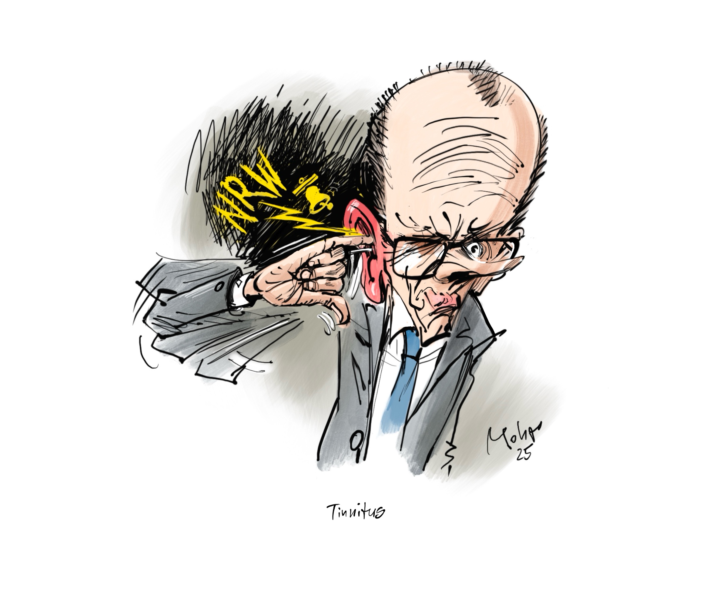 Tinnitus